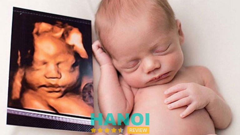Phòng Siêu Âm Ở Hà Nội: Lựa Chọn Tốt Nhất Cho Mẹ Bầu