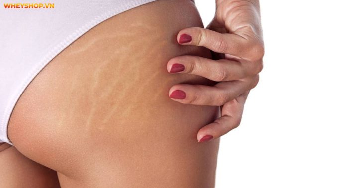 Phụ nữ sau sinh bị rạn da cần cách làm rượu nghệ bôi mặt để cải thiện