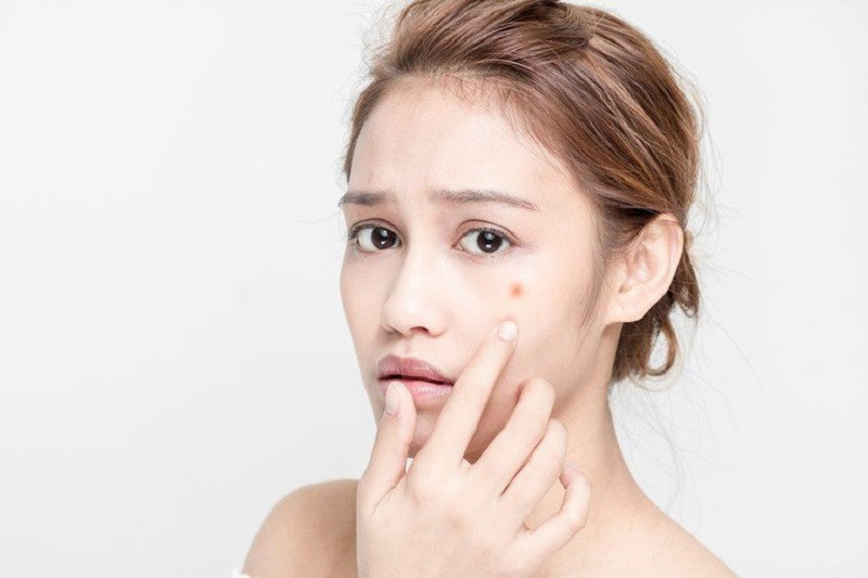 Mặt nạ dưỡng ẩm mùa đông: Giải pháp toàn diện cho làn da căng mịn