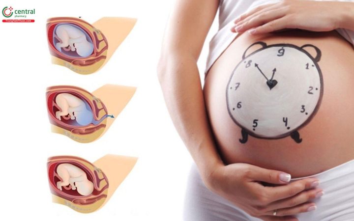 Quá trình chuyển dạ và mẹo dân gian giúp chuyển dạ nhanh