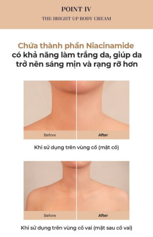 Sản phẩm kem dưỡng trắng da và chống lão hóa giúp cải thiện độ đàn hồi da