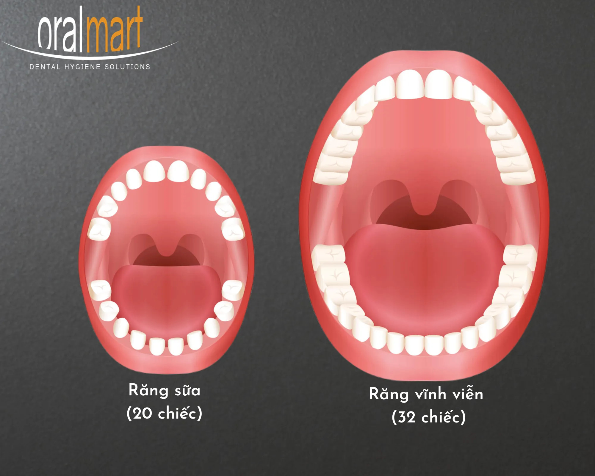 Sơ đồ 20 chiếc răng sữa của trẻ em và quá trình nứt lợi khi mọc