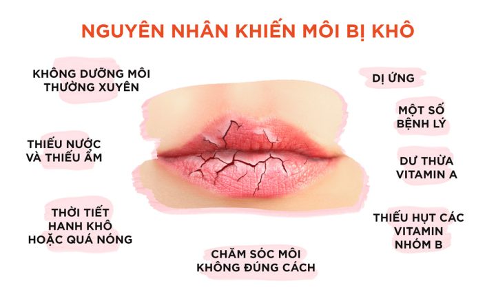 Son dưỡng Nivea có trị thâm môi không? Phân tích chuyên sâu và cách dùng hiệu quả