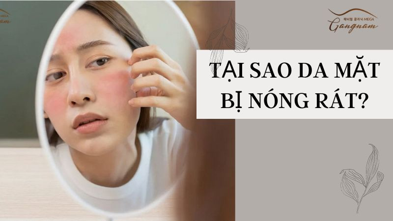 Tại Sao Da Mặt Bị Nóng Rát: Nguyên Nhân, Cách Khắc Phục Hiệu Quả