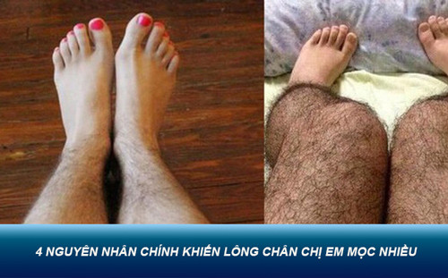 tẩy lông chân