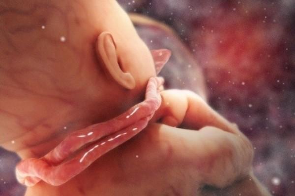 Mẹo chữa dây rốn quấn cổ cho thai nhi: Hướng dẫn chi tiết và an toàn