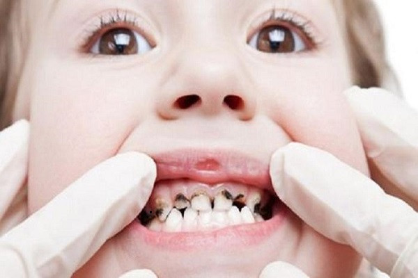 Trẻ em thiếu canxi thường khó ngủ, hay giật mình