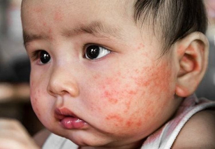 Dưỡng ẩm cho trẻ sơ sinh: Hướng dẫn toàn diện từ chuyên gia