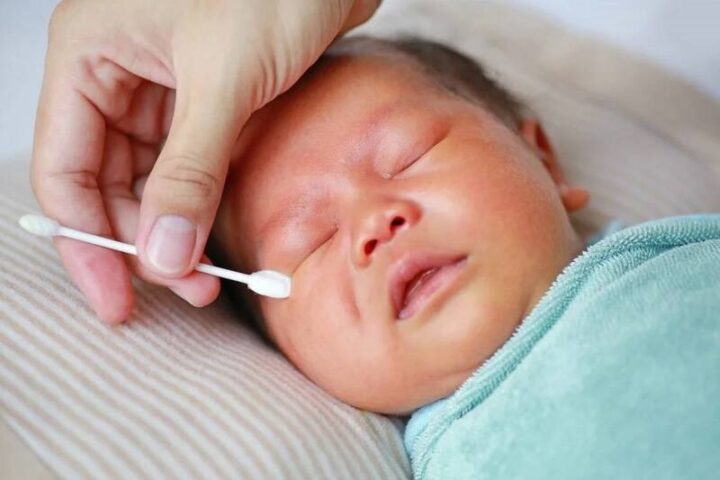 vệ sinh mắt trẻ sơ sinh bị đỏ mắt
