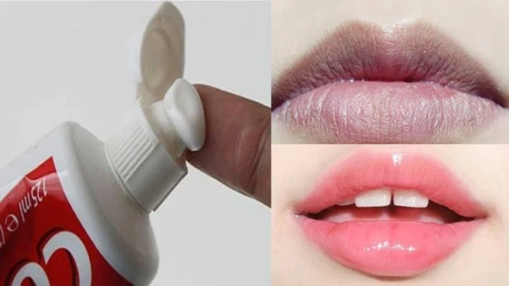 Trị Thâm Môi Bằng Kem Đánh Răng: Phương Pháp & Lưu Ý