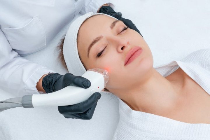 Triệt Lông Mặt Có Tốt Không: Lợi Ích, Nguy Cơ Và Cách Chăm Sóc