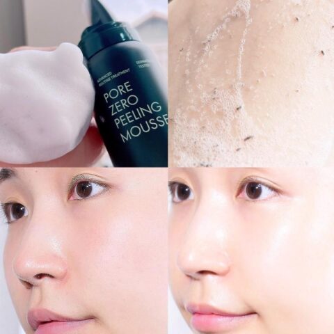 Neogen Pore Zero Peeling Mousse