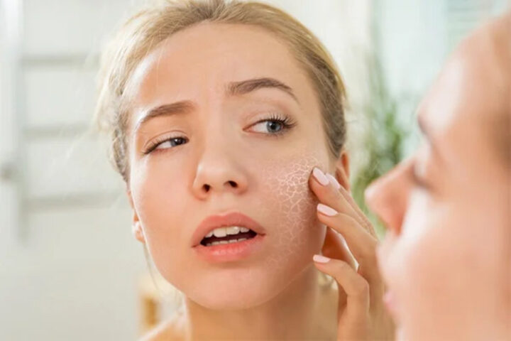 Vaseline bảo vệ làn da khỏi khô nẻ trong thời tiết hanh khô, đặc biệt là vùng môi và mặt.