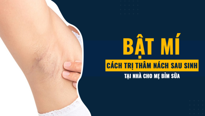 Cách Trị Thâm Sau Khi Sinh Hiệu Quả và An Toàn Tại Nhà