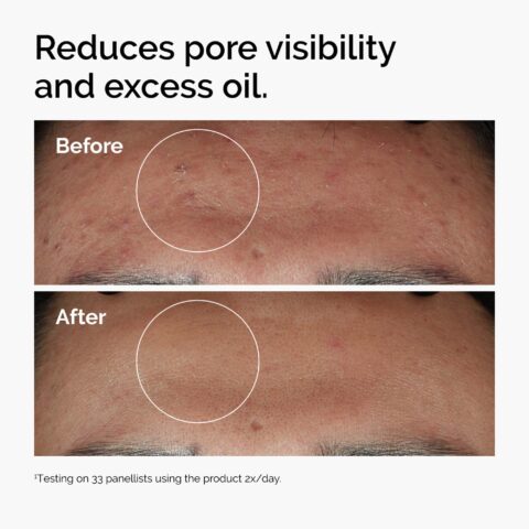 Cách sử dụng serum Ordinary Niacinamide 10% + Zinc 1% cho da sáng mịn