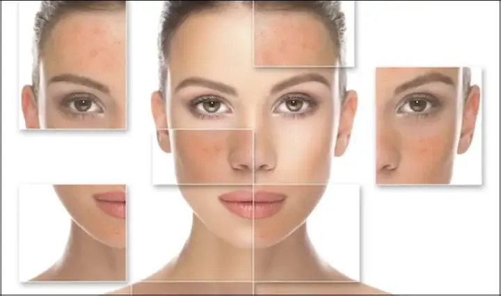 3.2 Gây viêm da kích ứng, dị ứng cho da