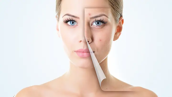 Hướng Dẫn Cách Dùng Nước Muối Sinh Lý Để Rửa Mặt Đúng Cách