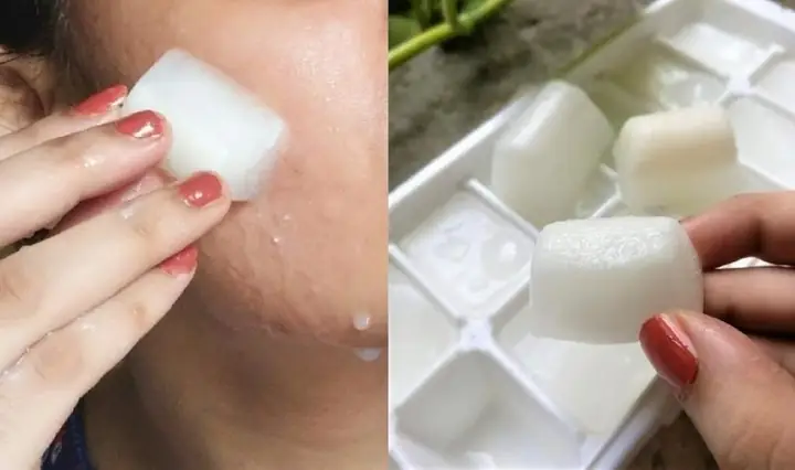 1.4.  Làm dịu vết cháy nắng