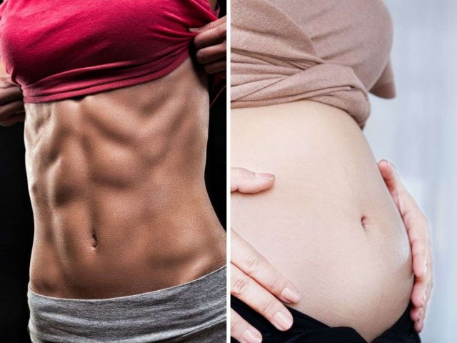 Có Nên Đeo Nịt Bụng Khi Tập Gym: Phân Tích Chuyên Sâu Từ Góc Nhìn Sức Khỏe Có Nên Đeo Nịt Bụng Khi Tập Gym: Phân Tích Chuyên Sâu Từ Góc Nhìn Sức Khỏe