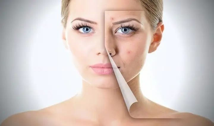 2Rửa mặt bằng nước muối sinh lý có tốt không?
