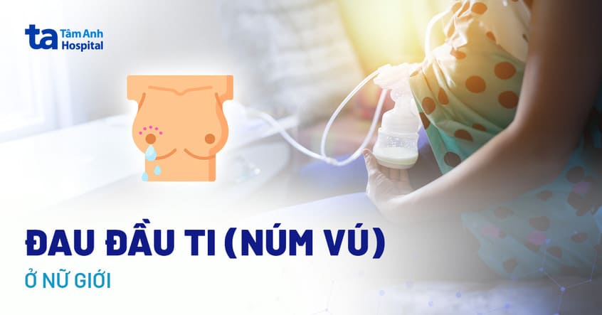 Đau Đầu Có Phải Dấu Hiệu Mang Thai: Giải Đáp Chi Tiết Đau Đầu Có Phải Dấu Hiệu Mang Thai: Giải Đáp Chi Tiết