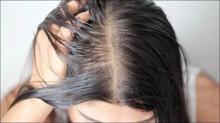 Chọn dầu gội trị gàu theo đặc tính da đầu