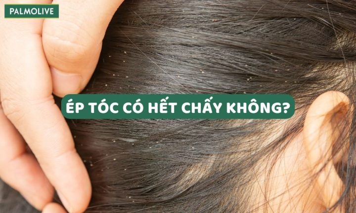 Ép tóc có hết chấy không: Phân tích chuyên sâu và giải pháp hiệu quả