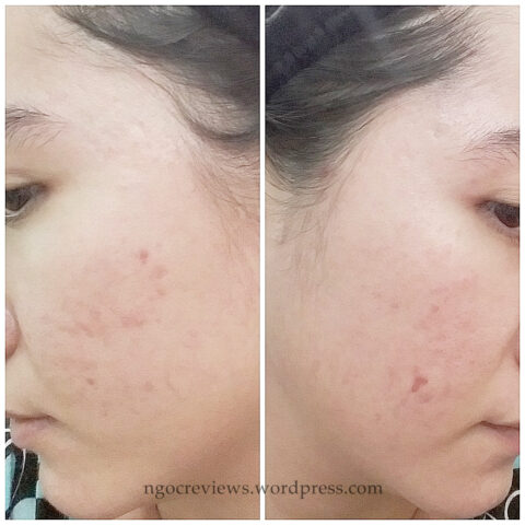 Review Mặt Nạ Naruko Ý Dĩ: Đánh Giá Chi Tiết Công Dụng và Trải Nghiệm Thực Tế