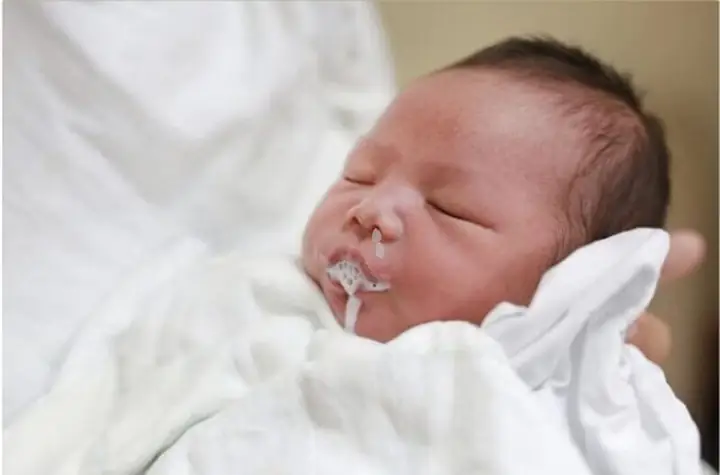 Chấn thương đầu từ trung bình đến nặng