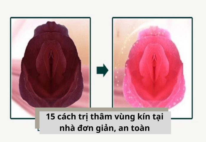 Cách Trị Thâm Sau Khi Sinh Hiệu Quả và An Toàn Tại Nhà