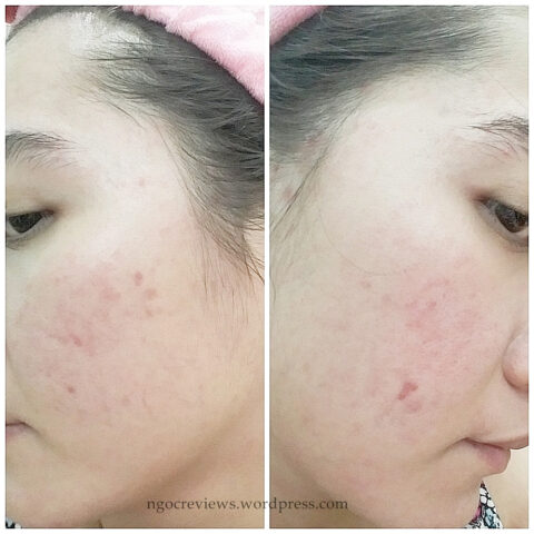 Review Mặt Nạ Naruko Ý Dĩ: Đánh Giá Chi Tiết Công Dụng và Trải Nghiệm Thực Tế
