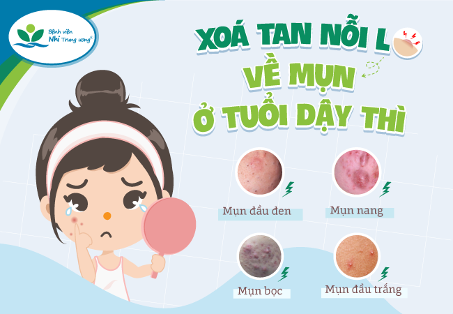 Cách Chăm Sóc Da Cho Tuổi Dậy Thì Đúng Chuẩn Chuyên Gia