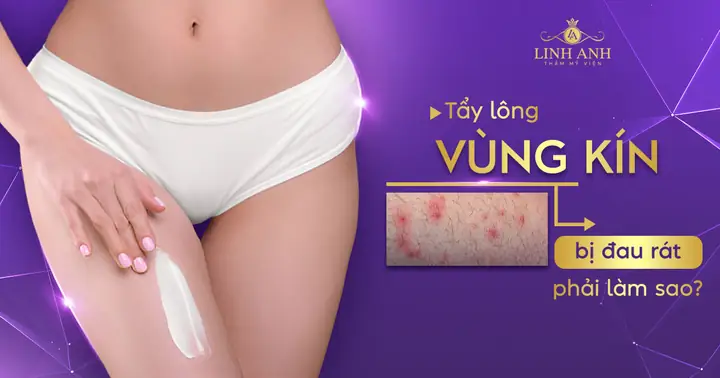 Tẩy lông vùng kín bị đau rát phải làm sao? – Chuyên gia giải đáp