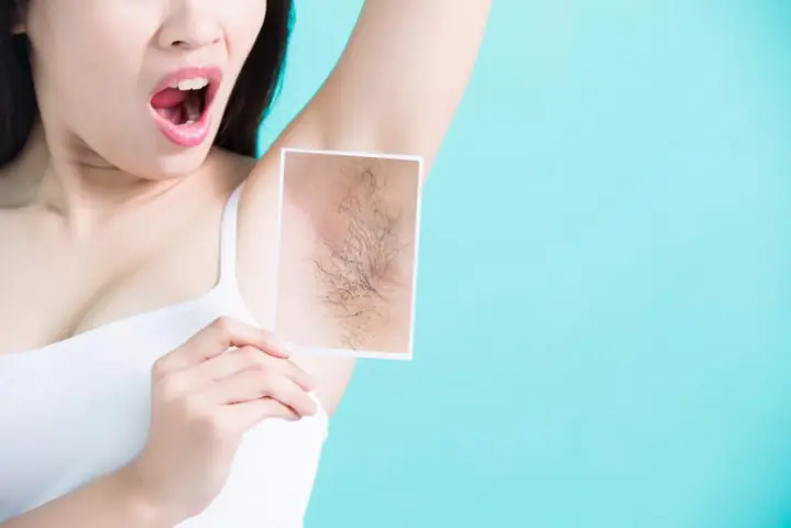 4. Lưu ý cho mẹ bầu khi nhổ lông nách tại nhà