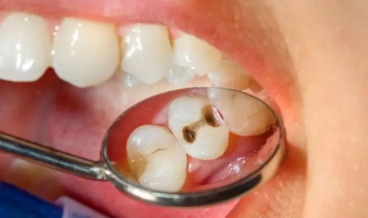 3Tác hại khi không vệ sinh răng miệng cho bé 1 tuổi