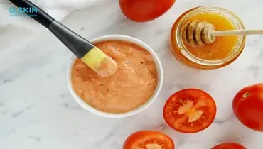 cách đắp dưa leo trị mụn