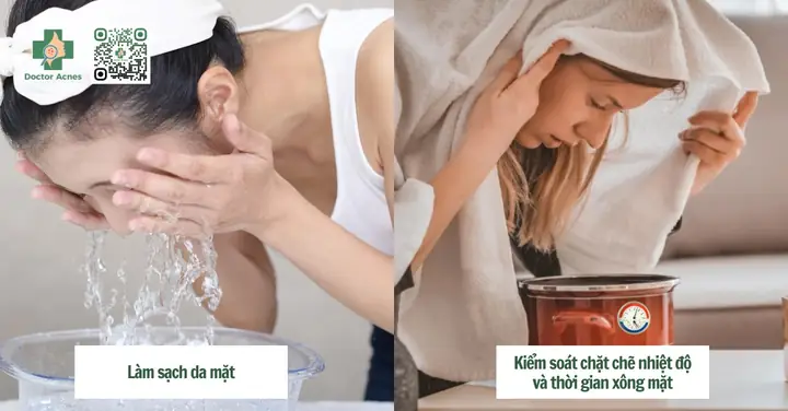 Các cách xông mặt trị mụn cho da nhờn