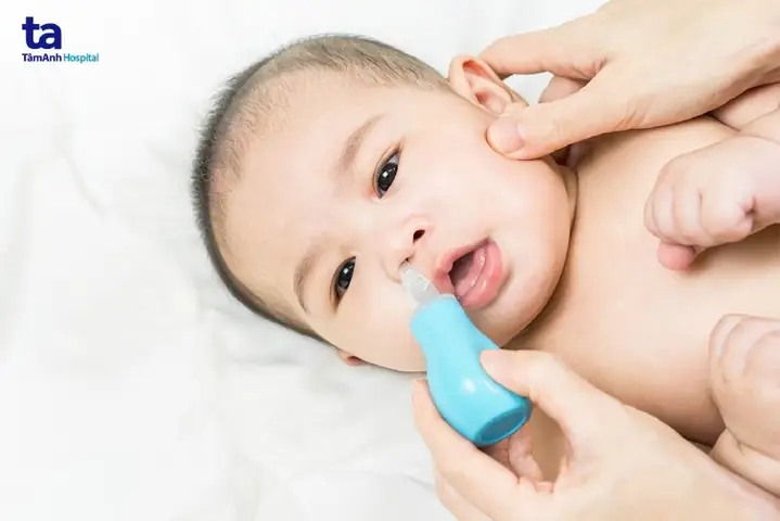 Cách trị sổ mũi cho bé 4 tháng an toàn và hiệu quả tại nhà