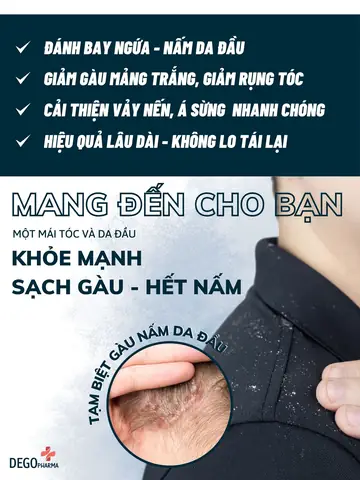 dầu gội đặc trị gàu mảng