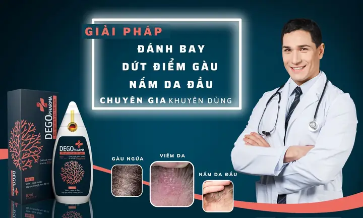 dầu gội đặc trị gàu mảng