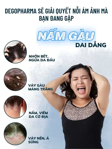 dầu gội đặc trị gàu mảng
