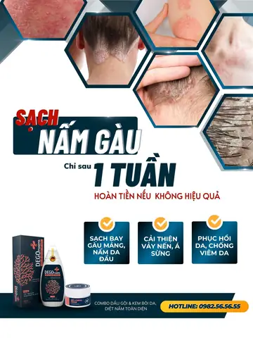 Thông tin sản phẩm