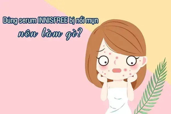 2. Giải đáp dùng serum Innisfree bị nổi mụn nên xử lý như thế nào