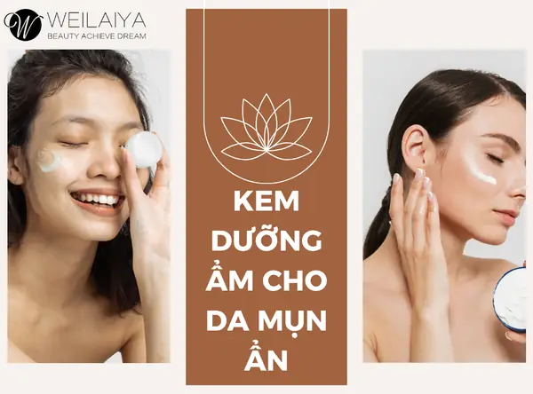 Review top 4 loại kem dưỡng ẩm cho da mụn ẩn nhất định phải biết