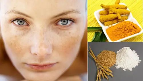 Lưu ý khi trị nám, tàn nhang bằng mặt nạ bột nghệ