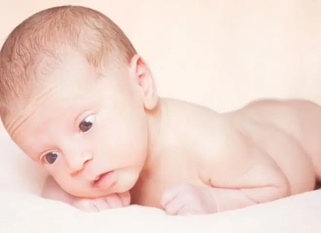 Các biểu hiện khác