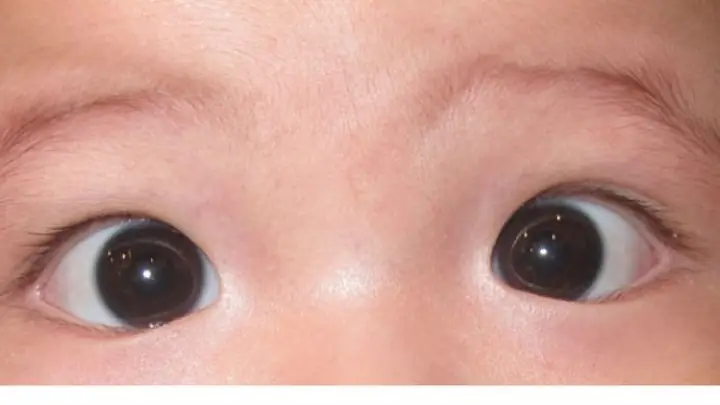 Cách nhận biết