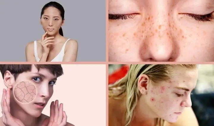 1Các vấn đề về da thường gặp sau sinh 1Các vấn đề về da thường gặp sau sinh