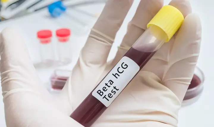 1.1 Hormone HCG tăng 1.1 Hormone HCG tăng