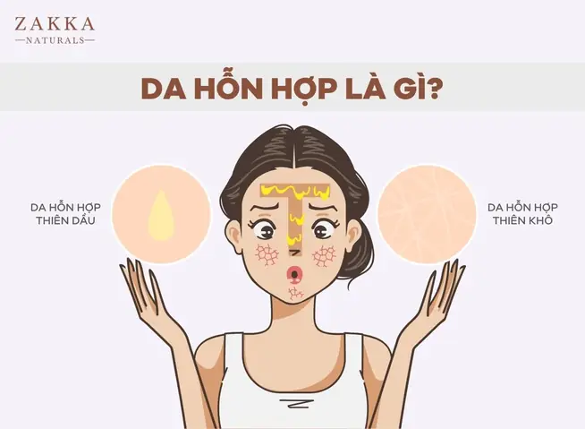 Da Hỗn Hợp Là Gì?